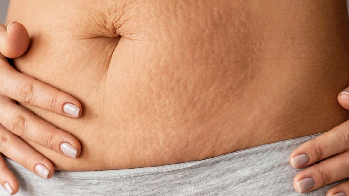 Get Your Pre-Baby Body Back With A Mommy Makeover